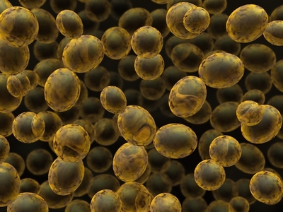 Prizewinner conjunto de HDBuzz: Estudios en levaduras sugieren una nueva forma de proteger las células del ‘daño oxidativo’